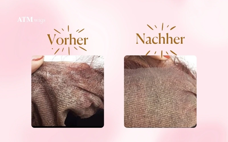 Before & After Remove Glue from Lace Front Wig Vorher & Nachher: Kleber von einer Lace-Front-Perücke entfernen