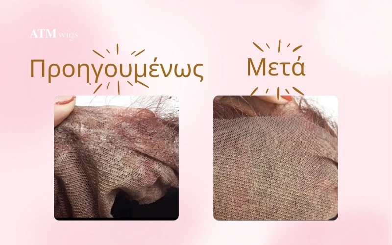 Before & After Remove Glue from Lace Front Wig Πριν & Μετά: αφαίρεση κόλλας από lace front περούκα