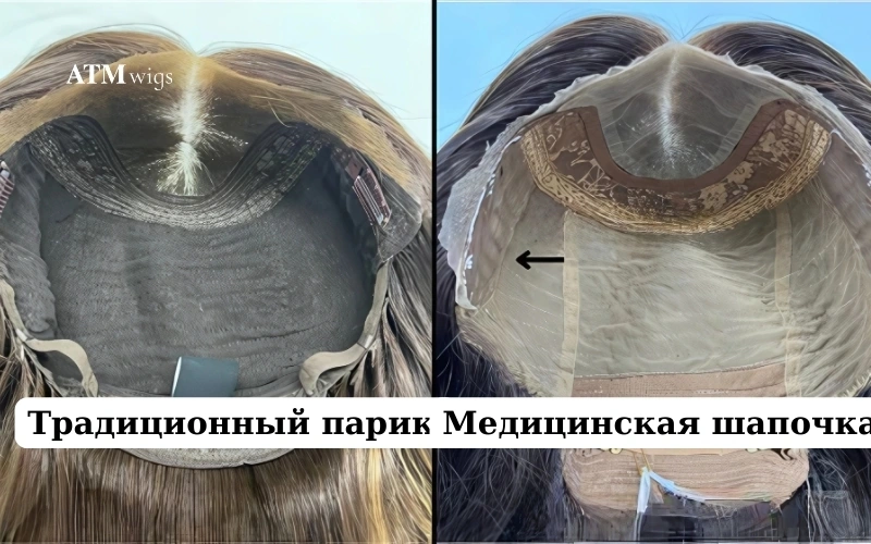 Обычный парик vs медицинский парик Обычный парик vs медицинский парик